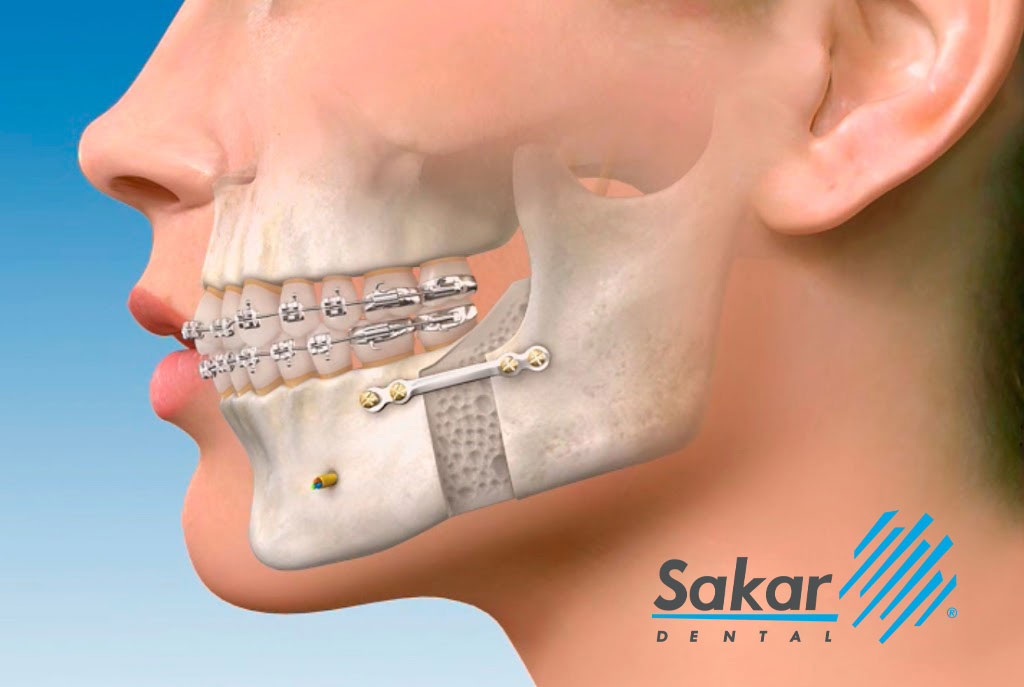 Cirugía maxilofacial en Polanco e Irrigación