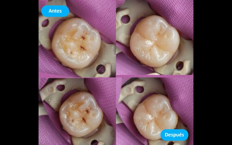 Before_After_2