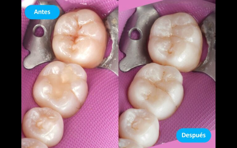 Before_After_3