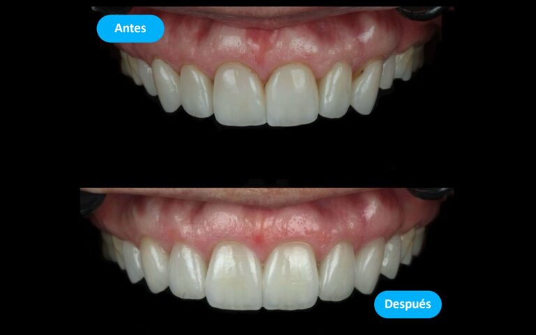 Before_After_4