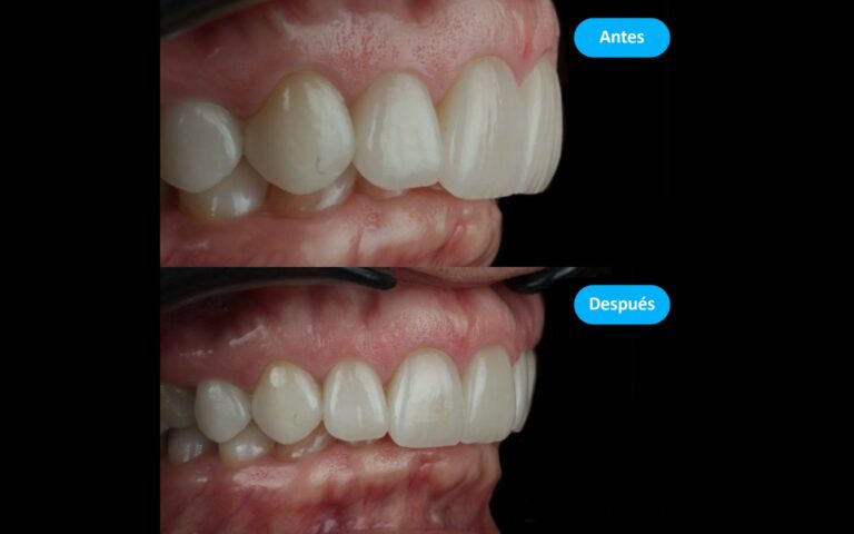 Before_After_5