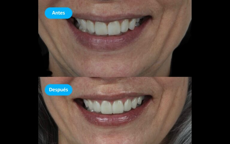Before_After_7